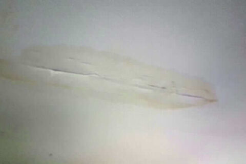 water damaged ceiling